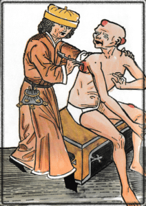 peste à l'époque des valois direct