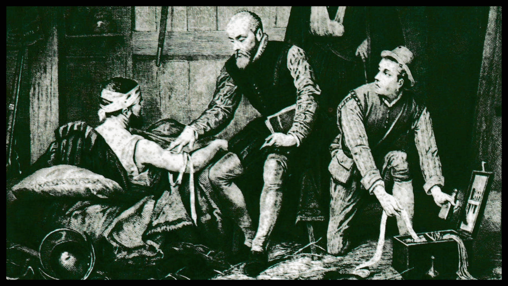 Amboise Paré à l'époque des Valois d'Angoulême
